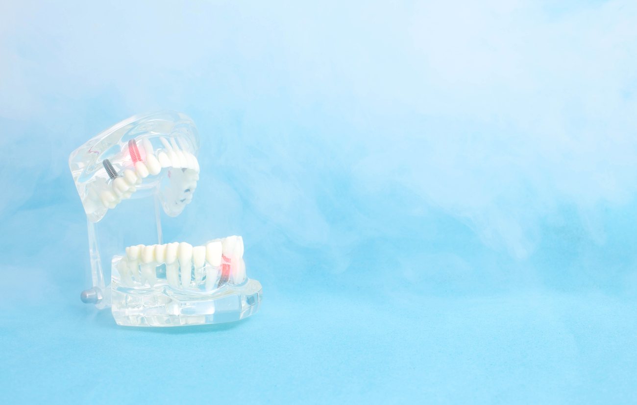 Ozone in dentistry