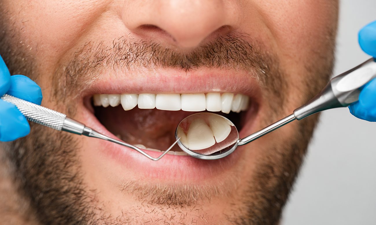 Treating Gum Inflammation